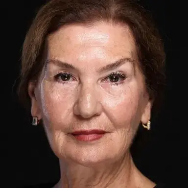Nesime Alış